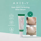 Axis-Y Dark Spot Correcting Glow Serum - 50ml
